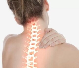 Osteocondrosi cervicale