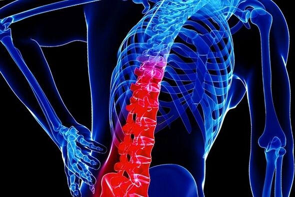 Le ragioni dello sviluppo dell'osteocondosi toracica